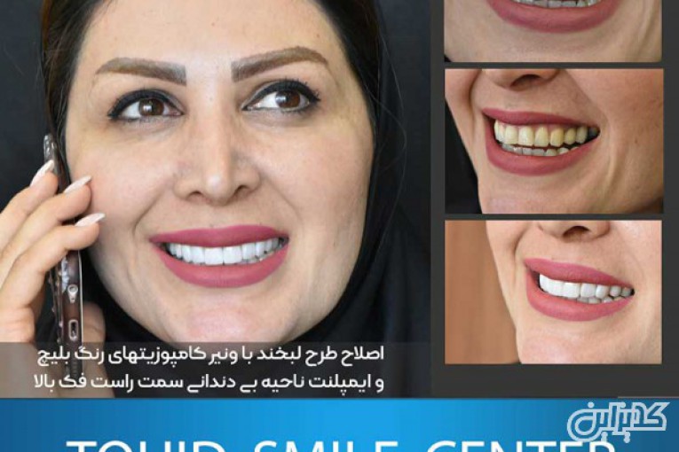 دکتر محمد عاطفت اصلاح طراحی لبخند در اصفهان
