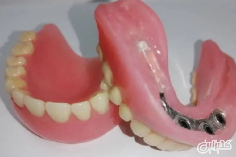 دندانسازی 